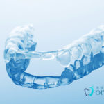 10代のためのインビザライン・ティーン