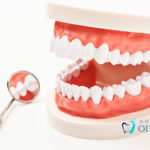 正常な噛み合わせと悪い噛み合わせ