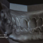 歯の仕組みを理解しよう