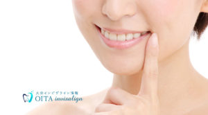 裏側矯正（舌側矯正）とは